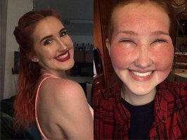 Иванушка, когда тебя аллергия ( отёк ) шибанёт, я очень хочу посмотреть, как ты в аптеку за антиистамином будешь нестись и орать на всю Ивановскую:
- Что за муйня?!