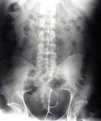 25 фотографий, которые вы ни за что не сможете понять