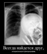 Как складываются кости в привлекательных позах, которые так любят модели?