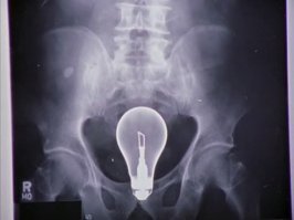 Как складываются кости в привлекательных позах, которые так любят модели?