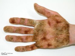 О чем говорят волосатые ладони знают все. А к чему волосатые ногти?