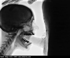 Как складываются кости в привлекательных позах, которые так любят модели?