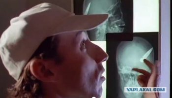 Семенов, у тебя ранения были?   Какие ранения?   Пулевые в голову?   Не было.   А это что?