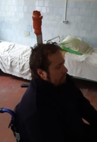 Эт что, тут вот один клоун по дурке решил голову проковырять, чтоб мозги подышали. Что характерно, в мозг не попал за отсутствием...
А вы говорите пингвинов увидел ))