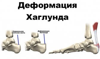 Это что-то с пятками связано...