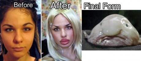 Самые дорогие пластические операции знаменитостей