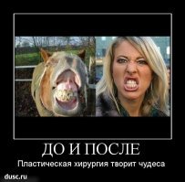 Самые дорогие пластические операции знаменитостей