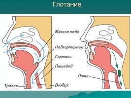 Для не понявших проблему ;)