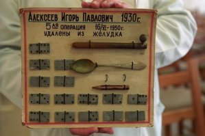 Китаец на спор проглотил ложку и прожил с ней в течение года