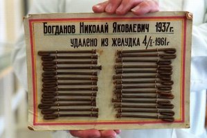 Китаец на спор проглотил ложку и прожил с ней в течение года