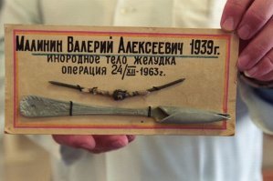 Китаец на спор проглотил ложку и прожил с ней в течение года