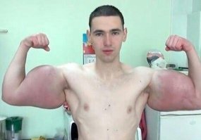 Вот он редкостный д.......б