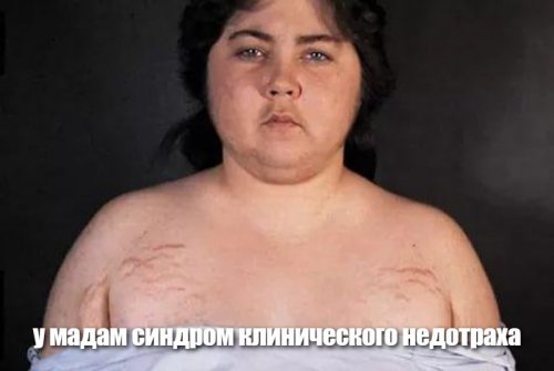 Врач-мужчина - это мужчина или врач?