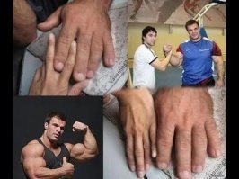 Цыпа: