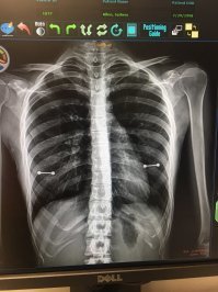 Кстати, это снимки двух разных женщин.