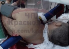 Норильские врачи прооперировали водителя, которого насквозь пронзило трубой после ДТП.
Сообщается, что ДТП произошло в норильском районе Талнах около 7 утра.
По данным ГИБДД, 31-летний водитель Audi A4 не был пристегнут.
Предварительно, он не справился с управлением и врезался в дорожное ограждение из труб. После этого иномарку развернуло, она врезалась в ограждение с другой стороны дороги и слетела в кювет.