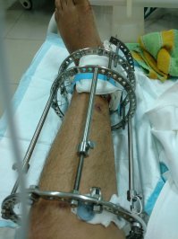 А еще там жил, работал и изобретал выдающийся хирург Илизаров Г. А. Если не ошибаюсь, то он наростил ногу знаменитому Туру Хейердалу. Да и вообще, за счет его методики возращена возможность полноценной жизни тысячам людей. К сожалению, не все люди там такие. Т.к. не место делает человека, а человек место.