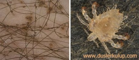 Вот, собсно, мандела собственной персоной (справа) и ее эффект (слева).