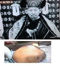 Называется ладка черепа. Делают в младенчестве. Вот факт из России.