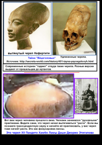 Называется ладка черепа. Делают в младенчестве. Вот факт из России.