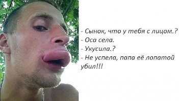 Парни, прекратите накачивать губы