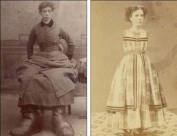 «Женщина-снежный человек» с огромными ступнями и женщина без рук.