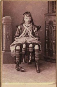 Миртл Корбин   женщина с четырьмя ногами.