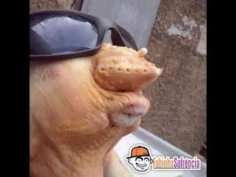 Парни, прекратите накачивать губы