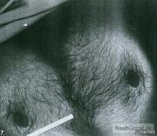 Родились с двумя X-хромосомами? Значит у вас явное преимущество