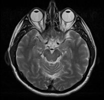 Крабик такой жил у меня.