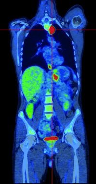 Сосуды с контрастом ("красителем") будь то МРТ или КТ это т.н. ангиография.
Еще есть фотоакустика (лазерный импульс вызывает ультразвуковое "эхо" в тканях). Позитронно-эмиоссионная томография (вводятся радиоактивные вещества в связке с молекулами-носителями, например глюкозой, что позволяет исследовать метаболизм и накопление этих молекул) итд итп.