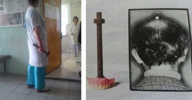 Лайфхак - если нет денег на стоматолога