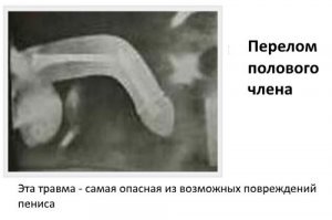 ну что тут скажешь..