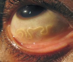 А вдруг это паразиты?