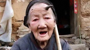 Её сёстры по несчастью, не знаю, помешало ли им это выйти замуж.