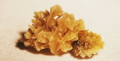 Вот самый дорогой камень никаких денег не хватит чтобы унять эту боль.