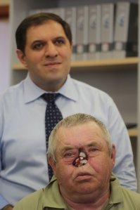 Зоошизики во всей красе. Гетеборгский университет - самый сильный в мире в плане имплантации. Именно там Пер Ингвар Броннемарк открыл феномен остеоинтеграции (о ужас - на кроликах!). Кто не знает - остеоинтеграция - это когда титан не отторгается организмом как инородная субстанция, а плотно приклеивается клетками к живым тканям. Работы этого университета сегодняя позволяют людям без зубов вновь получить радость от пищи. Людям без конечностей, с дефектами лица, позвоночника дают новую жизнь. Да, ученые используют животных, чтобы отработать новые разработки, прежде чем применять на людях. Но скажите этому человеку на фото, что вы готовы пожалеть 6 лабрадоров (которых умертвят максимально гуманно), но не дать ему обрести нормлаьное лицо. На фото - Сверху - несравненный московский анапластолог Артавазд Каразян и пациент после рака носа, которому установлены два скуловых имплантата Nobel zygoma (разработанные как раз в Университете Гетеборга) для фиксации искусственного носа.