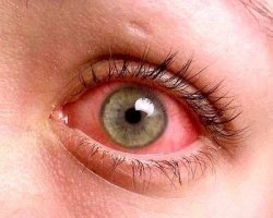 Есть небольшая побочка)