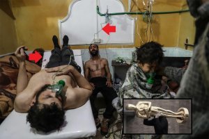 Оскара этим мужественным парням! Дабы не портить грязными носками трагичность сцены  - "умирающего" развернули ногами на изголовье и прокинули шланг через всю сцену.
Кстати, здесь есть медики? Я не специалист, но мне кажется что трубки слишком тонкие для ингаляции - дышать через них невозможно. Опять же, в ингаляторе нужен парогенератор, а здесь концы трубок просто опущены в колбы (физраствор?)