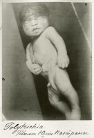 А вот ее ребенок