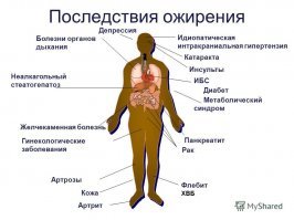 Я вот не пойму.....Когда постят эти толстые рожи, то это типа от зависти???

Ожирение   это накопление жира в организме, приводящее к появлению избыточной массы тела. При этом жир откладывается в жировых депо организма (подкожной жировой клетчатке и вокруг внутренних органов).

К концу XX века учёные  доказали, что люди, страдающие избыточным весом, вместе с лишними килограммами приобретают предрасположенность к таким серьезным заболеваниям, как сахарный диабет, гипертония, инфаркт миокарда и рак.