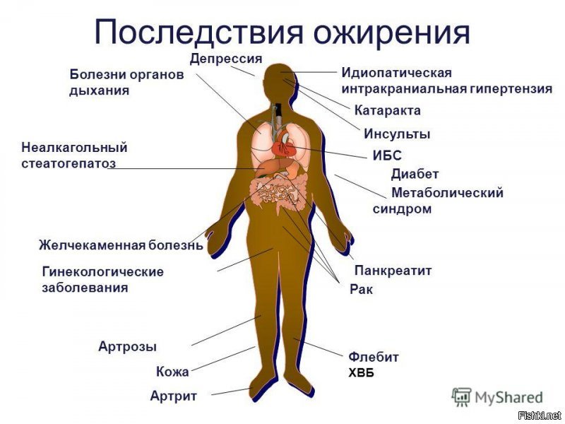Я вот не пойму.....Когда постят эти толстые рожи, то это типа от зависти???

Ожирение   это накопление жира в организме, приводящее к появлению избыточной массы тела. При этом жир откладывается в жировых депо организма (подкожной жировой клетчатке и вокруг внутренних органов).

К концу XX века учёные  доказали, что люди, страдающие избыточным весом, вместе с лишними килограммами приобретают предрасположенность к таким серьезным заболеваниям, как сахарный диабет, гипертония, инфаркт миокарда и рак.