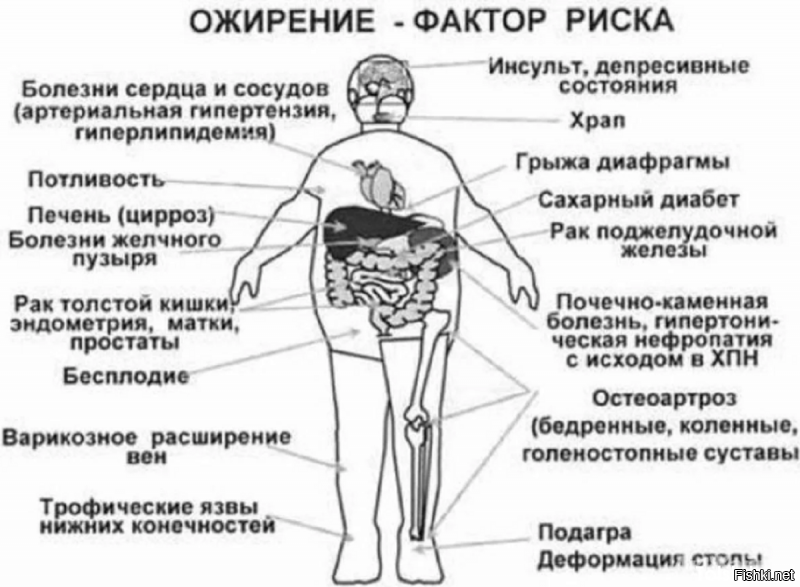 Я вот не пойму.....Когда постят эти толстые рожи, то это типа от зависти???

Ожирение   это накопление жира в организме, приводящее к появлению избыточной массы тела. При этом жир откладывается в жировых депо организма (подкожной жировой клетчатке и вокруг внутренних органов).

К концу XX века учёные  доказали, что люди, страдающие избыточным весом, вместе с лишними килограммами приобретают предрасположенность к таким серьезным заболеваниям, как сахарный диабет, гипертония, инфаркт миокарда и рак.