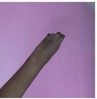 20 фотографий людей, чьё тело имеет необычные особенности