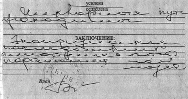 Ликворные пути проходимы.
Эхопризнаки последствий ишемического поражения гол. мозга. Штонеясна?