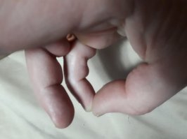 Мизинец с большим пальцем в кольцо замкни одновременно на двух руках
Три раза, не больше икнешь и всё пройдет