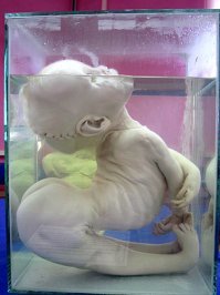 И все сразу представили себе таких детей-инвалидов над которыми она призывала насмехаться......


По форме она сказала она неправильно а вот по сути 100% верно........

В школе нас водили в Кунсткамеру и показывали заспиртованных детей которые рождались от наркоманов и алкоголиков .......Бл*дь    вот это было жутко, страх пробирался до самых кишок.......
И сразу возникал вопрос который и задавался экскурсоводу "А почему их не усыпляли при рождении ведь известно что они 100% не жильцы!"
Ответ: таков закон.........

Т.е. они должны были отмучиться 1-2, некоторые неделю .........особенно запомнилось про людей с большой головой , такие доживали до 5 лет..........