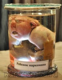 И все сразу представили себе таких детей-инвалидов над которыми она призывала насмехаться......


По форме она сказала она неправильно а вот по сути 100% верно........

В школе нас водили в Кунсткамеру и показывали заспиртованных детей которые рождались от наркоманов и алкоголиков .......Бл*дь    вот это было жутко, страх пробирался до самых кишок.......
И сразу возникал вопрос который и задавался экскурсоводу "А почему их не усыпляли при рождении ведь известно что они 100% не жильцы!"
Ответ: таков закон.........

Т.е. они должны были отмучиться 1-2, некоторые неделю .........особенно запомнилось про людей с большой головой , такие доживали до 5 лет..........