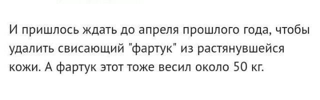 Тушенкина, ты вообще читаешь что копипастишь?

После операции, женщина за одну ночь потеряла 50кг.
А потом, после удаления фартука ещё 50кг.

Как можно потерять за одну ночь 50кг?
Ты дура чтоли?