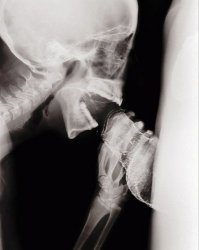 16 удивительных рентгеновских снимков беременных животных